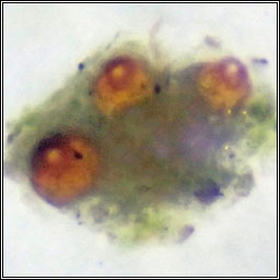 Xenonectriella subimperspicua