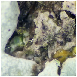 Didymocyrtis epiphyscia sens str