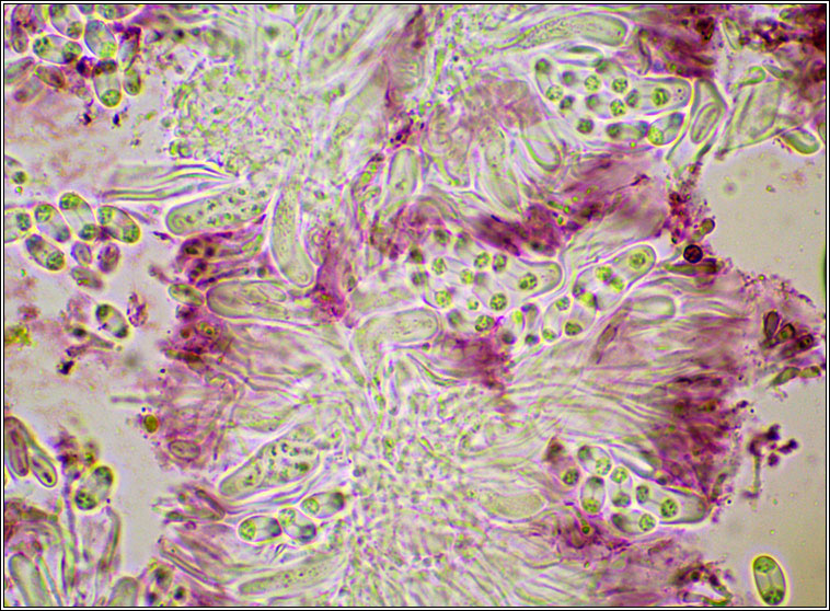 Caloplaca cerinelloides, asci and spores