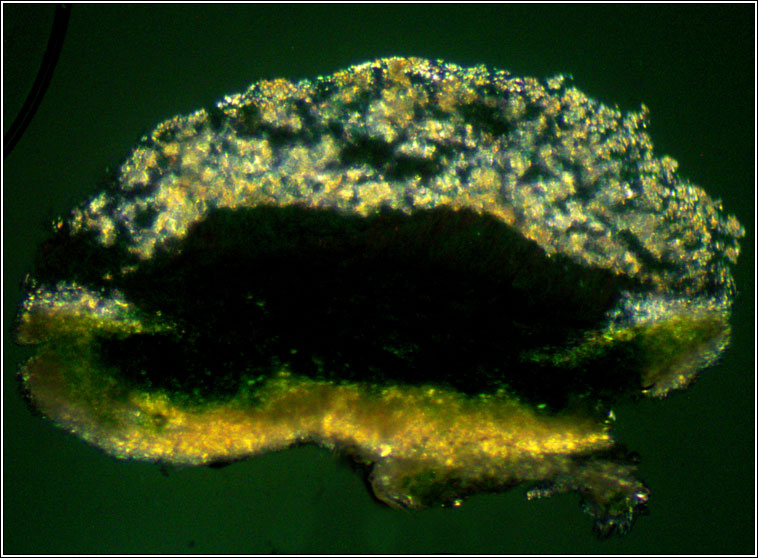 Lecanora carpinea
