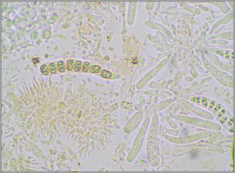 Xenonectriella subimperspicua