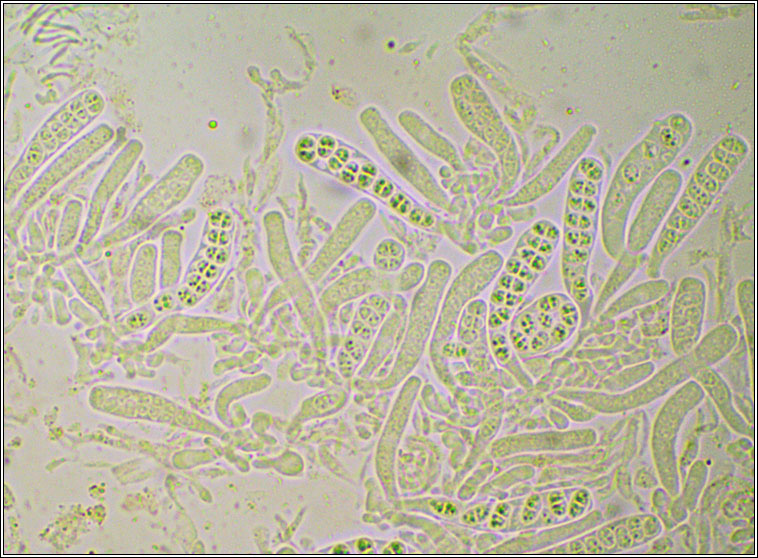 Xenonectriella subimperspicua