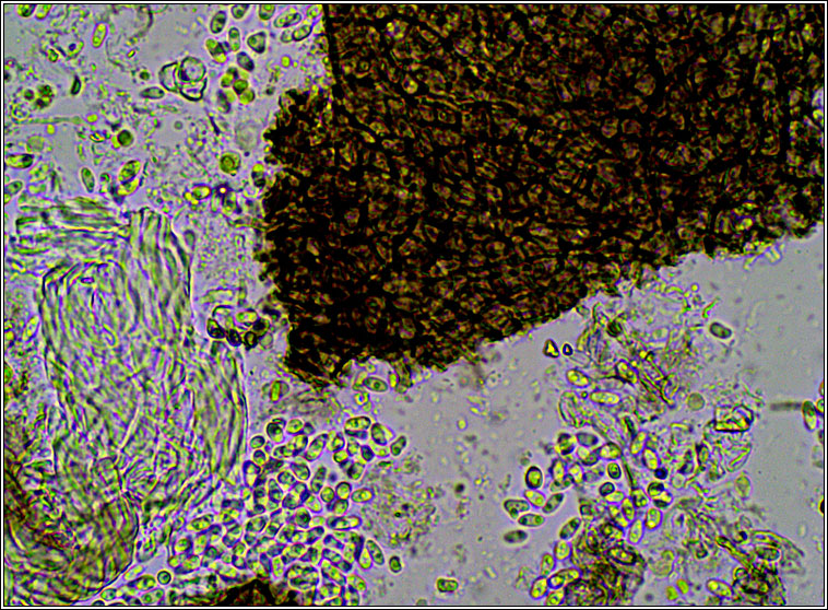 Didymocyrtis epiphyscia sens str