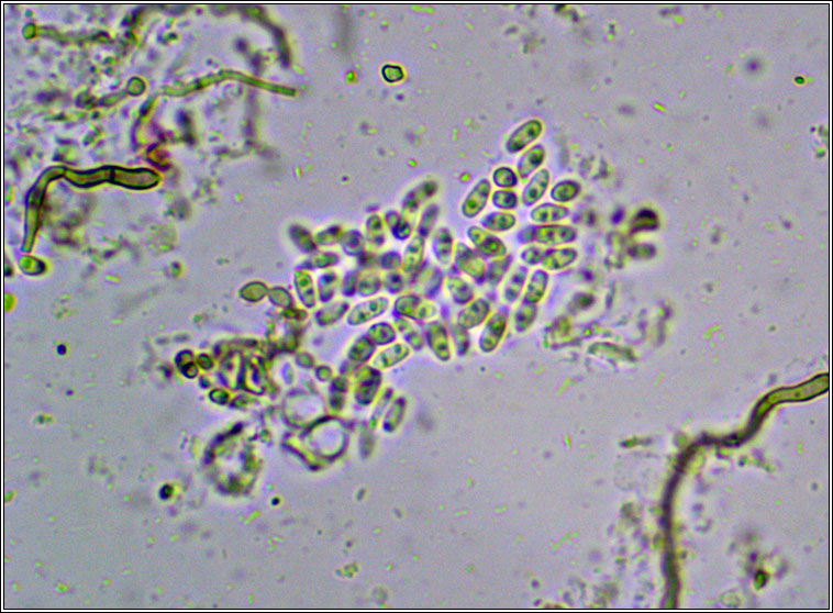 Didymocyrtis epiphyscia sens str